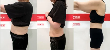 전 → 후 → 유지
